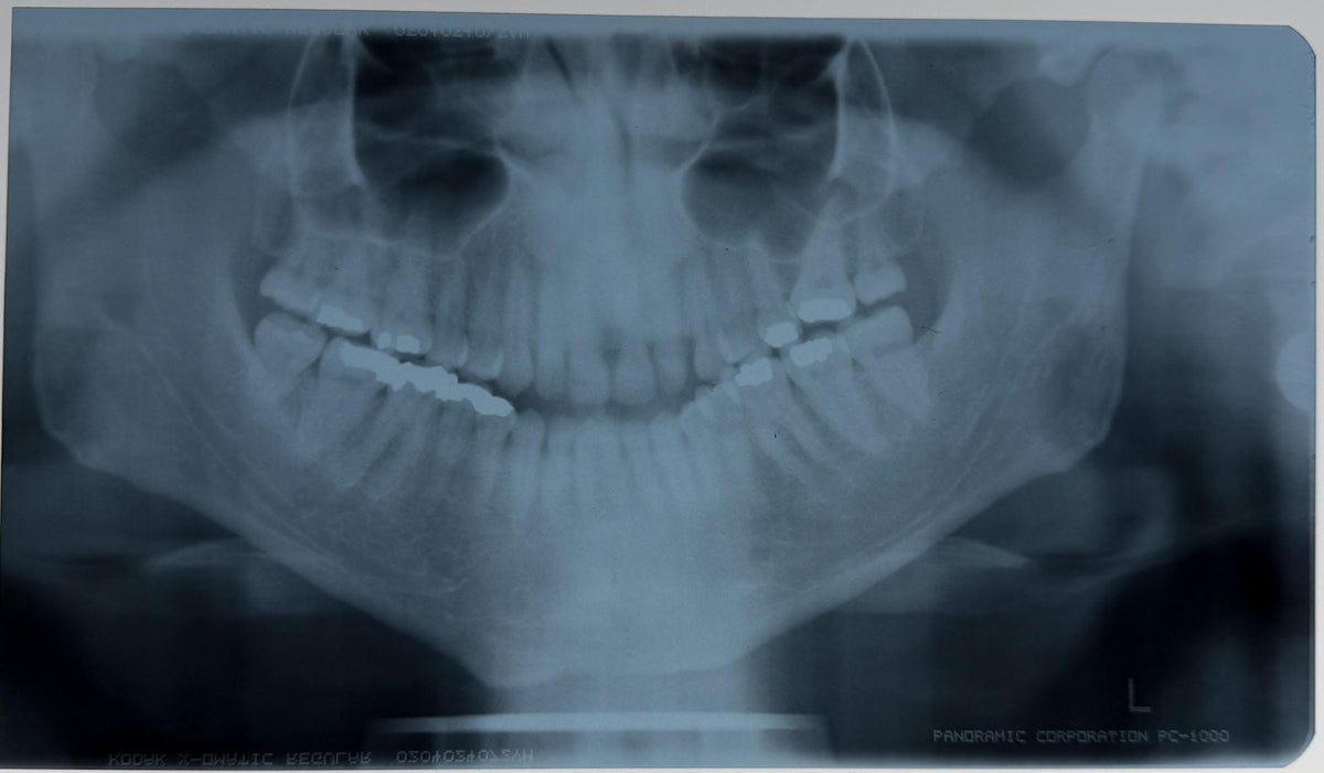 Real Dental X-Ray Mystery Pull