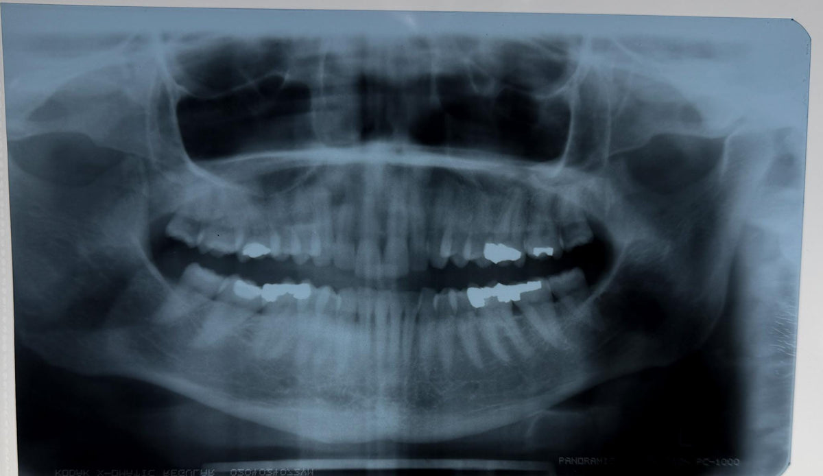 Real Dental X-Ray Mystery Pull