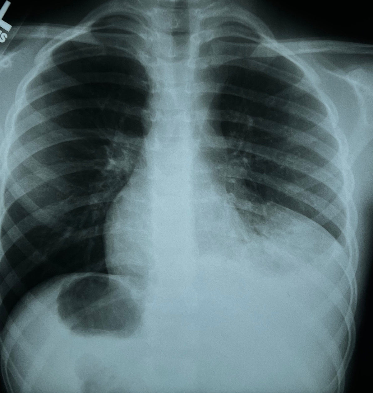 Human X-Ray Mystery Radiograph Bundles