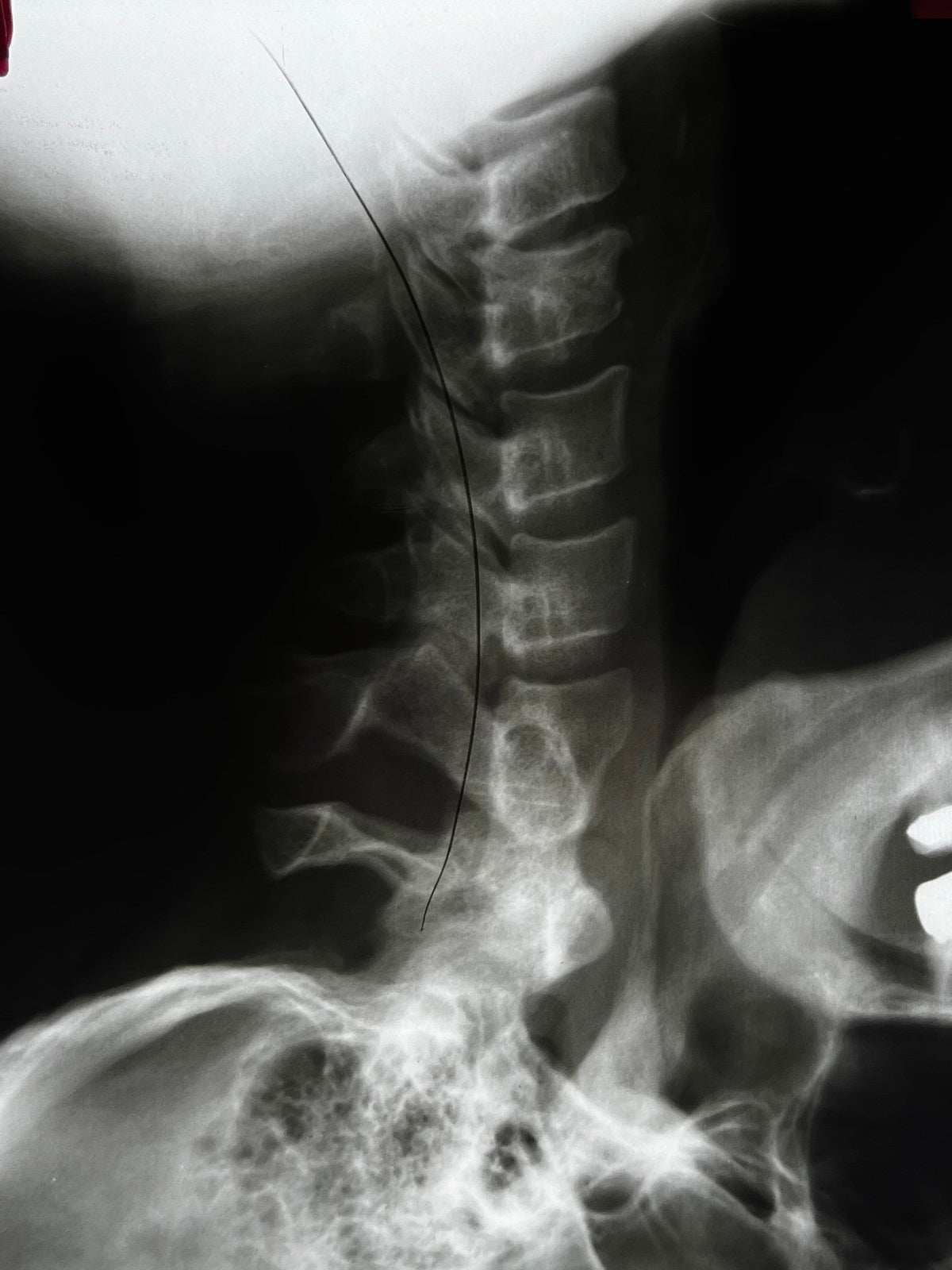 Human X-Ray Mystery Radiograph Bundles