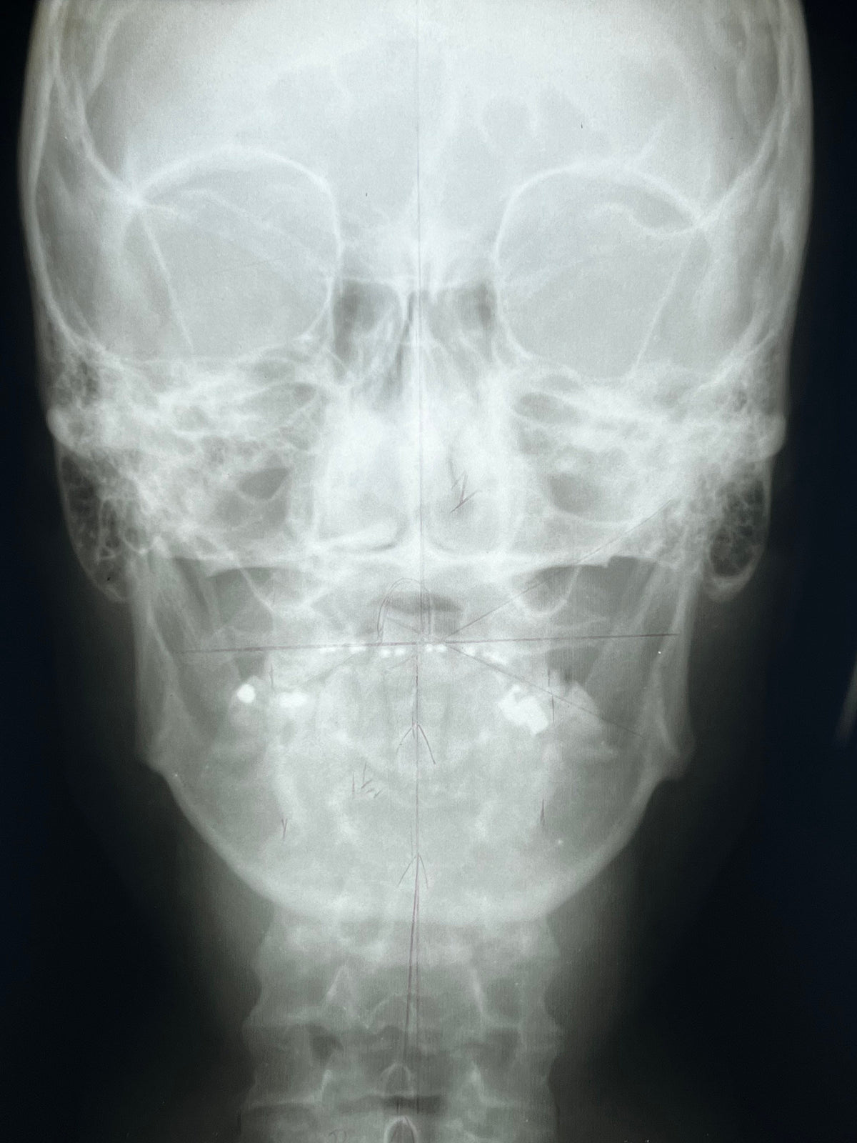 Human X-Ray Mystery Radiograph Bundles