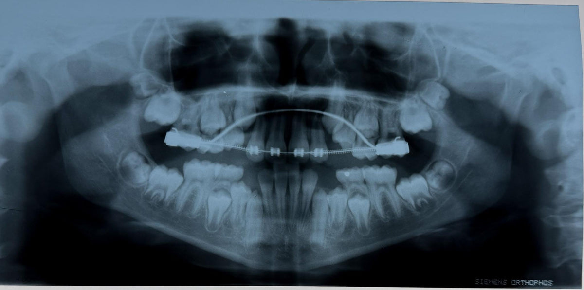 Real Dental X-Ray Mystery Pull