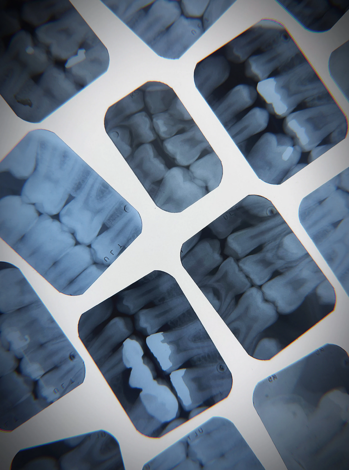 Real Dental X-Ray Mystery Pull