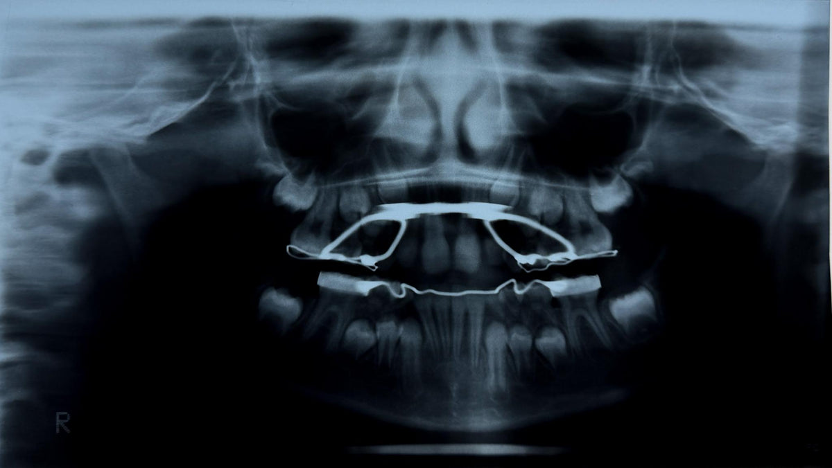 Real Dental X-Ray Mystery Pull