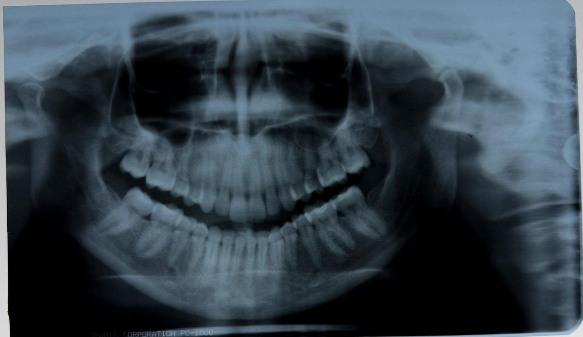 Real Dental X-Ray Mystery Pull