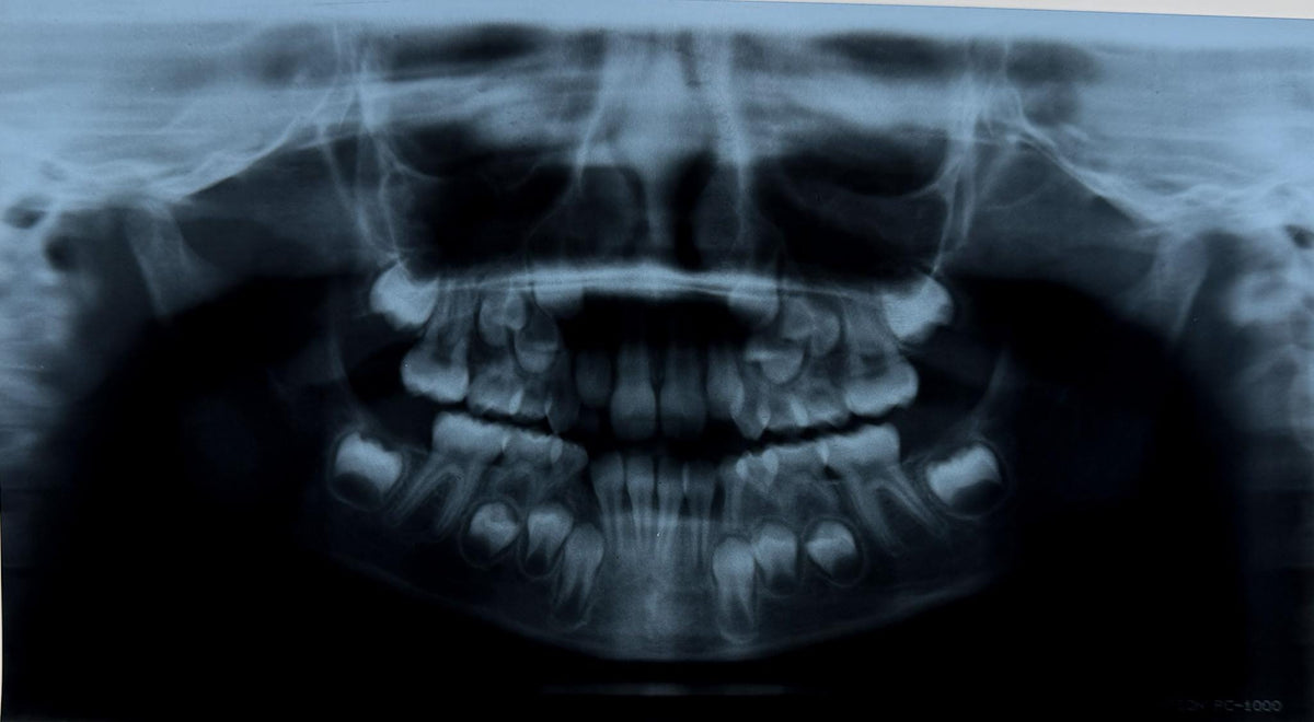 Real Dental X-Ray Mystery Pull