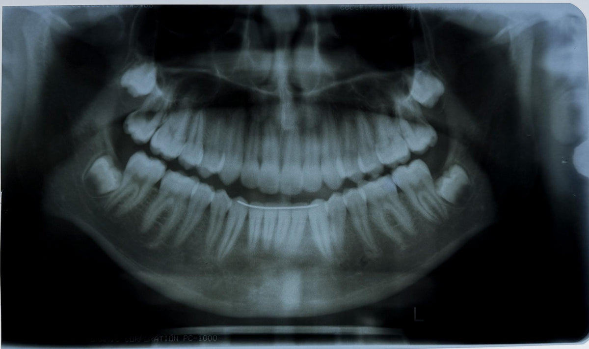 Real Dental X-Ray Mystery Pull
