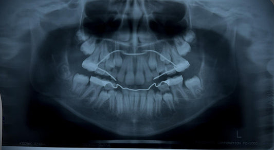 Real Dental X-Ray Mystery Pull