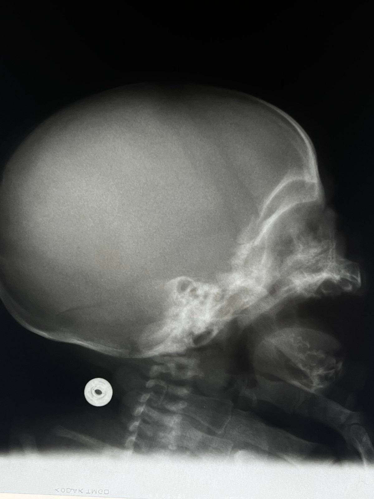 Human X-Ray Mystery Radiograph Bundles