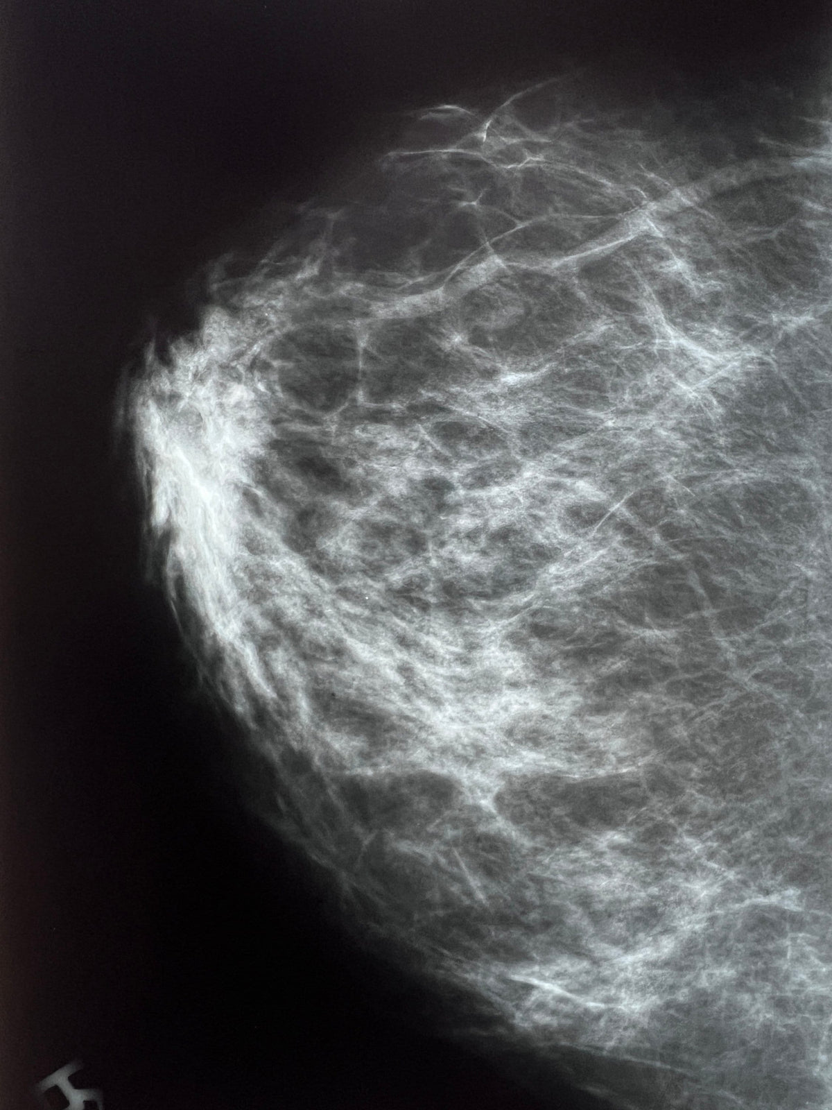 Human X-Ray Mystery Radiograph Bundles