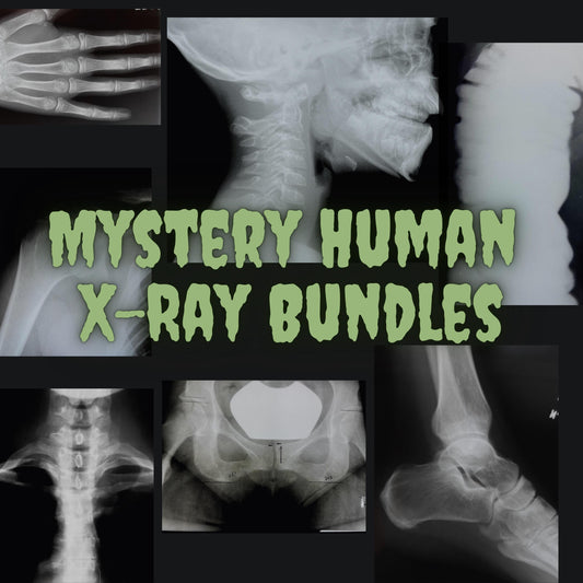 Human X-Ray Mystery Radiograph Bundles