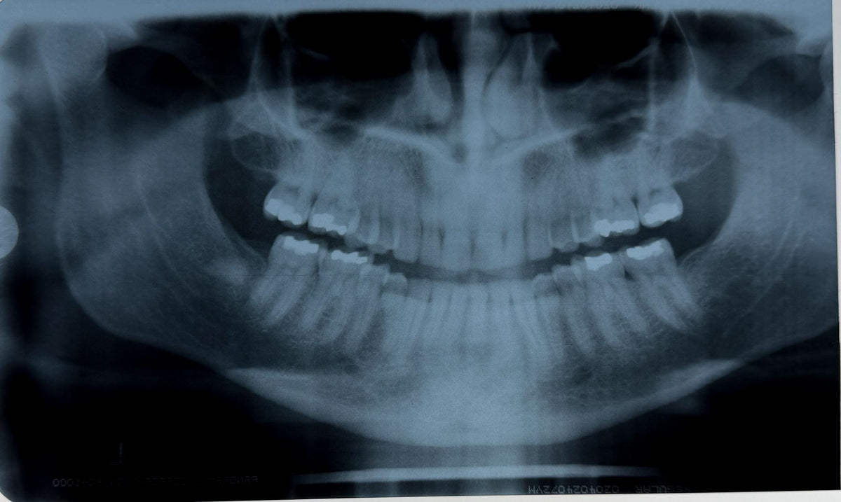 Real Dental X-Ray Mystery Pull