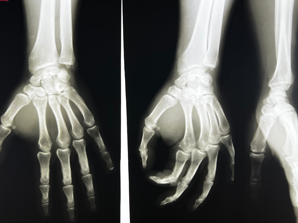 Human X-Ray Mystery Radiograph Bundles