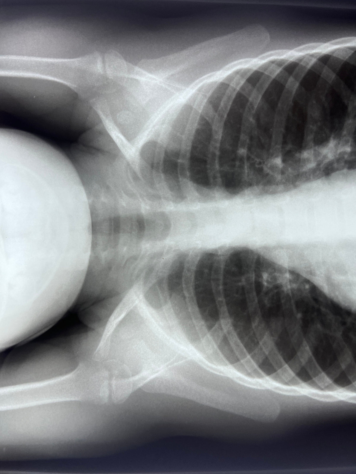Human X-Ray Mystery Radiograph Bundles