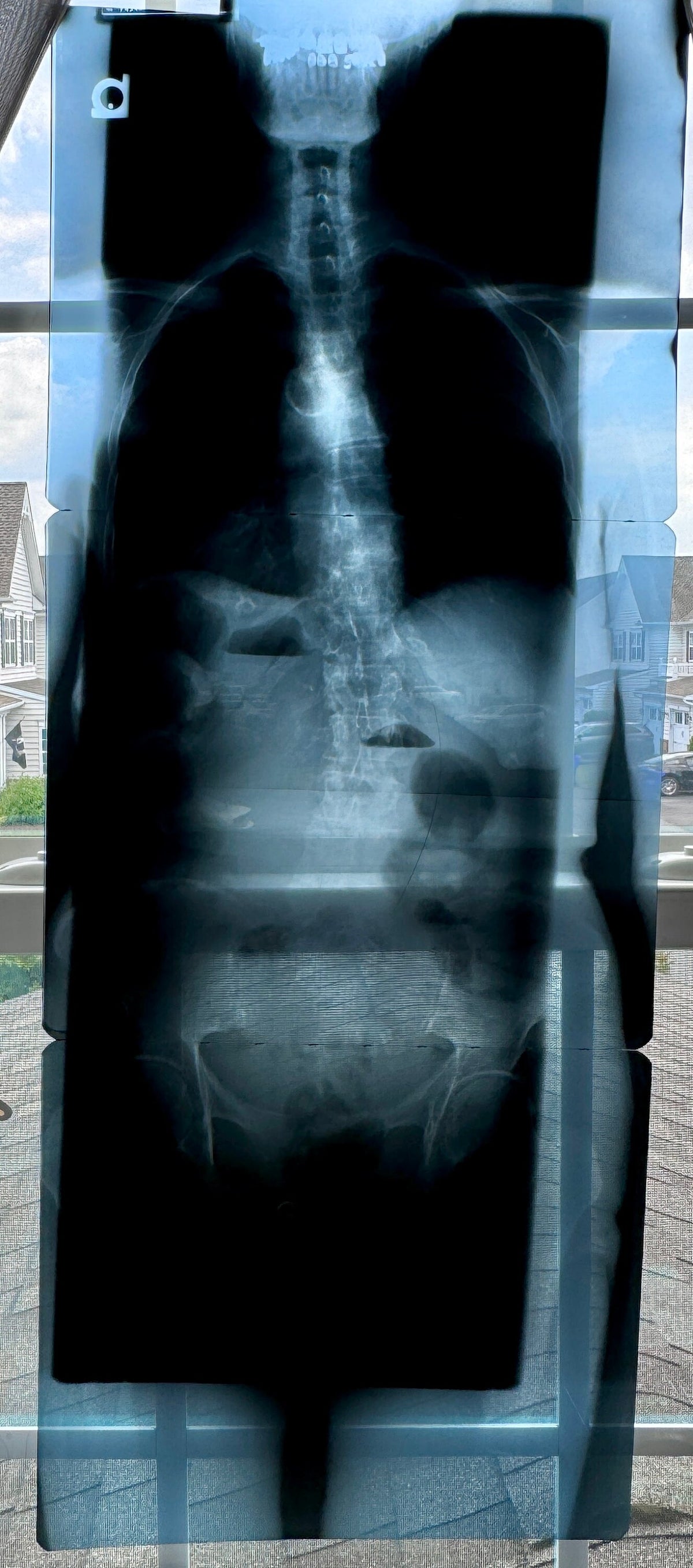 Human X-Ray Mystery Radiograph Bundles
