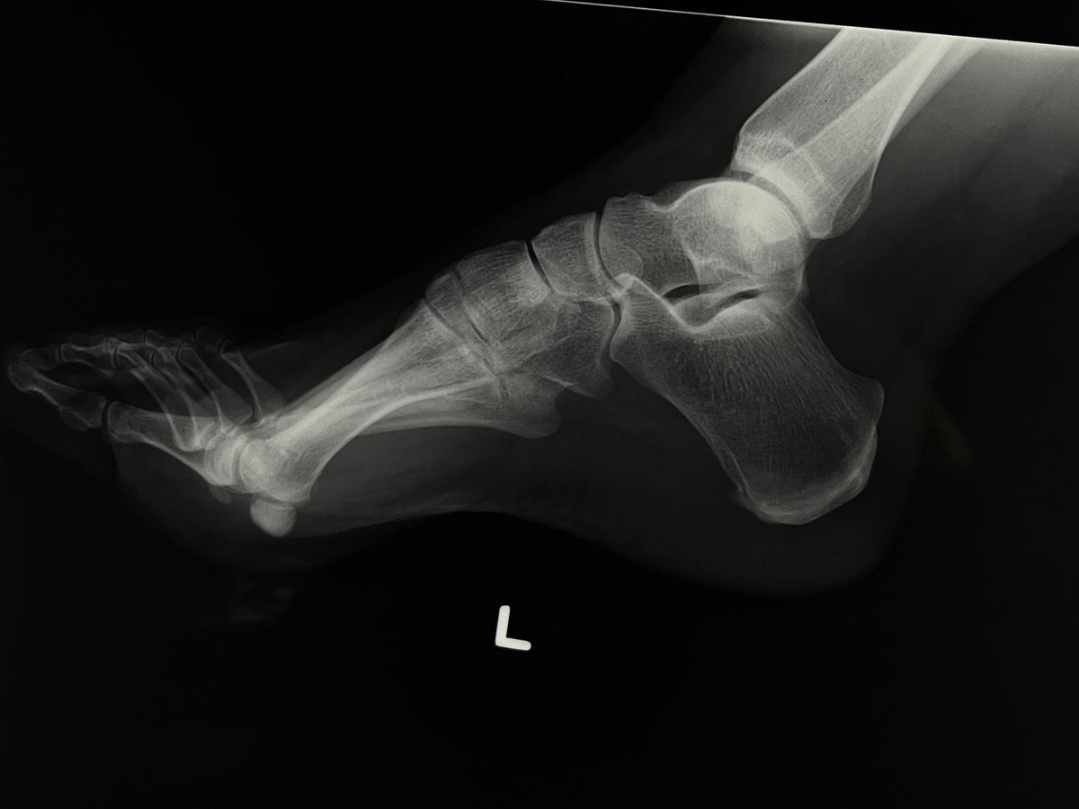 Human X-Ray Mystery Radiograph Bundles