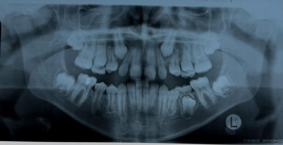 Real Dental X-Ray Mystery Pull